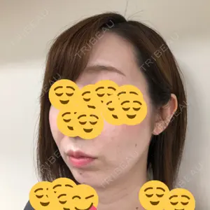 口コミ