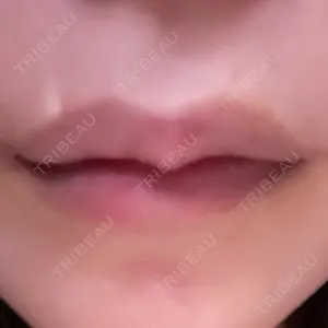 アリエル美容クリニック アリエル美容クリニック 横浜院口コミ