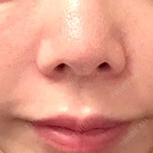 AURORA CLINIC（オーロラクリニック）新宿院口コミ