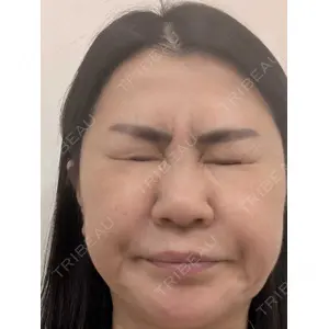 TCB東京中央美容外科 TCB東京中央美容外科 松山院口コミ