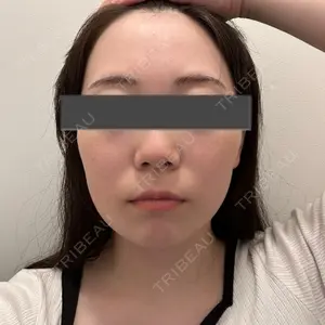 新宿ラクル美容外科クリニック 新宿ラクル美容外科クリニック 新宿院口コミ