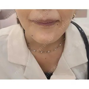 ルラ美容クリニック ルラ美容クリニック 広島院口コミ