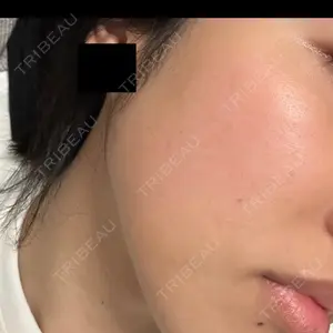 ハナビューティークリニック口コミ