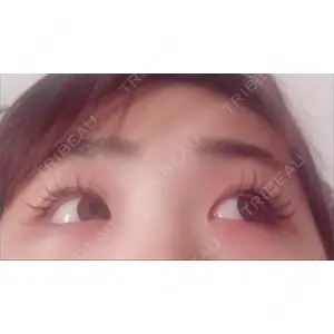 ラミチェ美容整形外科口コミ