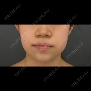 医療法人社団 優美会 GRACIA Casa de GRACIA GINZA 【カーサデグラシアギンザ】口コミ
