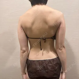 AVAN TOKYO 銀座脂肪吸引 クリニックの