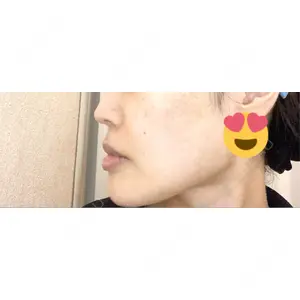 アラジン美容クリニック口コミ