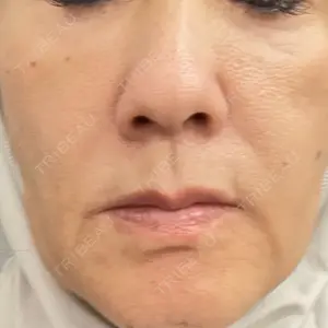 東京シルククリニック 東京シルククリニック 東京神田院口コミ