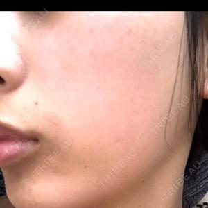 ルラ美容クリニック ルラ美容クリニック 静岡院口コミ