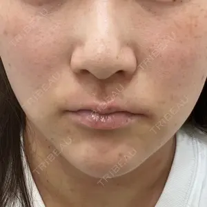 渋谷美容外科クリニック 渋谷美容外科クリニック 横浜院口コミ