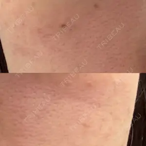 NEO Skin Clinic NEO Skin Clinic恵比寿口コミ