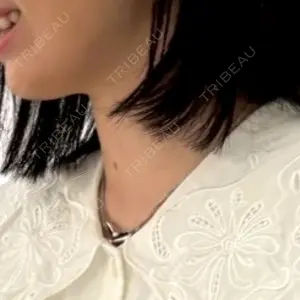 plume clinic plume clinic口コミ