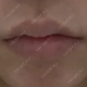 プライベートスキンクリニック 梅田本院口コミ