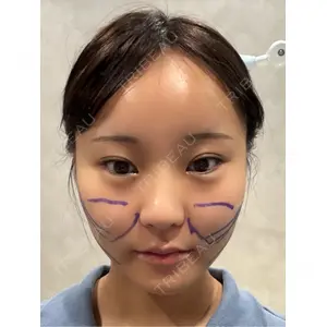 Nebula Clinic 札幌美容外科ネビュラクリニック口コミ