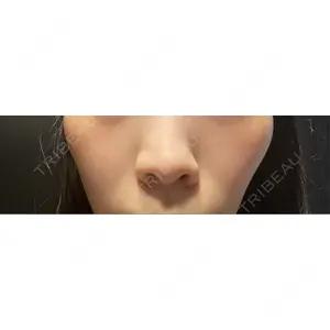 L‘amour clinic Tokyo【ラムールクリニック東京】口コミ