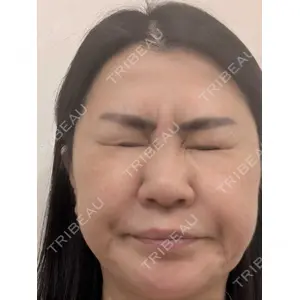 TCB東京中央美容外科 TCB東京中央美容外科 松山院口コミ