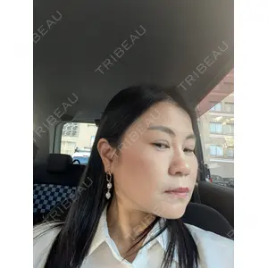 TCB東京中央美容外科 TCB東京中央美容外科 松山院口コミ