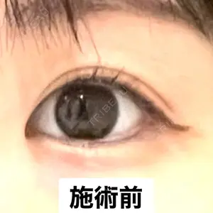 TCB東京中央美容外科 TCB東京中央美容外科 大宮東口院口コミ