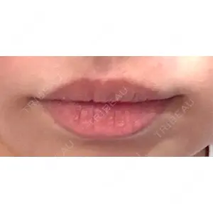 新未来クリニック口コミ