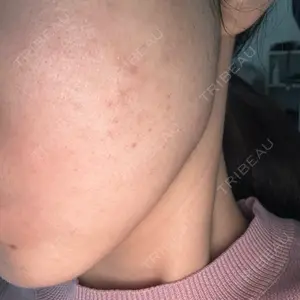 ARTE SKIN CLINIC 【アルテスキンクリニック】口コミ