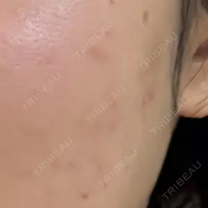 ルラ美容クリニック ルラ美容クリニック 大宮院 / ルラスキンクリニック 大宮院口コミ