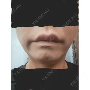 ルラ美容クリニック ルラ美容クリニック 広島院口コミ