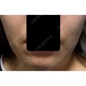 APスキンクリニック銀座口コミ