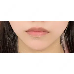 フィラークリニック フィラークリニック 大阪心斎橋院口コミ