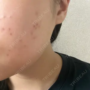 レジーナクリニック エトワールレジーナクリニック 表参道院口コミ