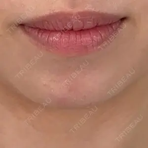 アリエル美容クリニック アリエル美容クリニック 横浜院口コミ