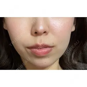TCB東京中央美容外科 TCB東京中央美容外科 岐阜院口コミ