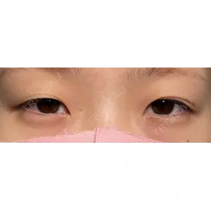 HAAB×DREAM BEAUTY CLINIC HAAB×DREAM BEAUTY CLINIC 大阪梅田院口コミ