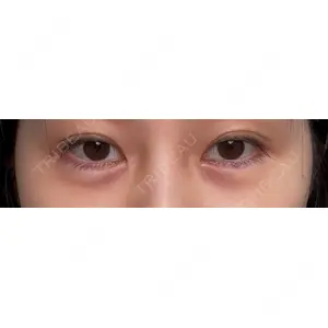 HAAB×DREAM BEAUTY CLINIC HAAB×DREAM BEAUTY CLINIC 東京本院口コミ