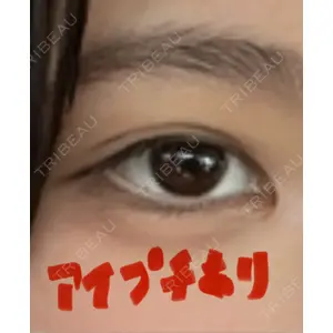 大塚美容形成外科 大塚美容形成外科 銀座本院口コミ
