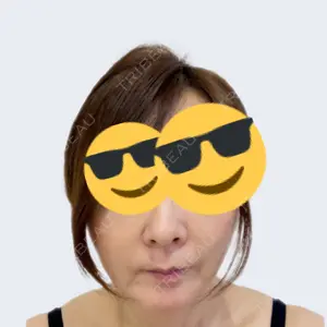 東京シンデレラ美容外科 東京シンデレラ美容外科 池袋院口コミ