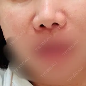 ルラ美容クリニック ルラ美容クリニック 札幌院口コミ