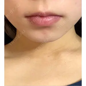 口コミ