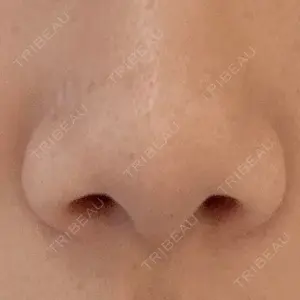 アネシス美容クリニック口コミ