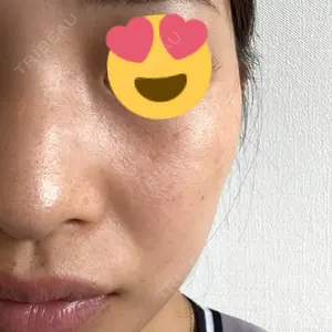 PureMe Skin Clinic（ピュアミースキンクリニック麻布）口コミ