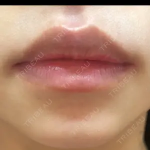 銀座美容外科クリニック 銀座美容外科クリニック 銀座院口コミ