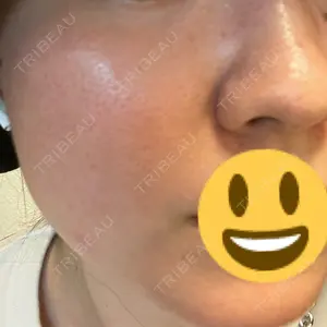 東京シルククリニック 東京シルククリニック 東京神田院口コミ