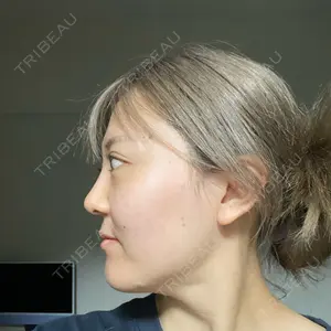 エートップ美容整形外科口コミ