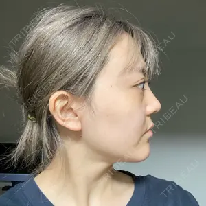 エートップ美容整形外科口コミ