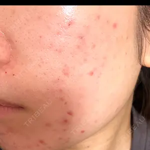 Natural Skin Clinic Natural Skin Clinic 笹塚院口コミ