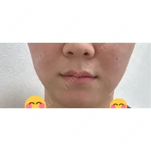 アリエル美容クリニック アリエル美容クリニック 横浜院口コミ