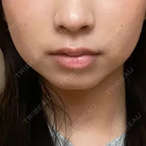 銀座美容外科クリニック 銀座美容外科クリニック 銀座院口コミ