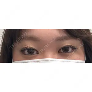 口コミ