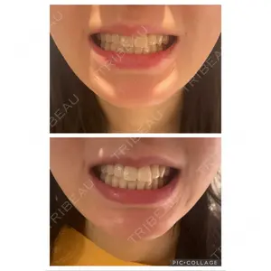 麻布十番クレールデンタルクリニック口コミ