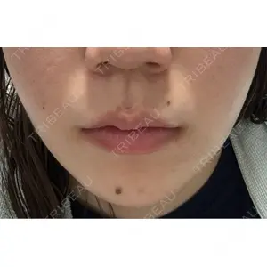 APスキンクリニック銀座口コミ