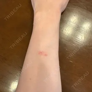 アムルーズ美容外科クリニック アムルーズ美容外科クリニック 大阪院口コミ